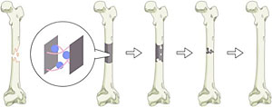 image of bone regeneration